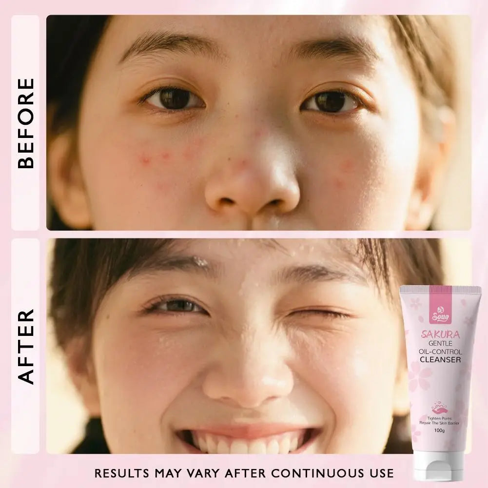 Sakura Gentle Deep Cleanser – Oil Control & Pore Care, 100g