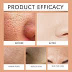 Facial Exfoliating Cream – Clear Pores, Brighten, Fade Dark Spots & Deep Cleanse