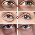 Instant Eye Lift Cream – Collagen Anti-Wrinkle & Dark Circle Remover