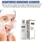 Whitening Facial Cleanser – Fades Dark Spots, Reduces Melasma, Brightens & Smooths Skin, Anti-Acne & Moisturizing Care