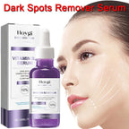 Powerful Dark Spot Remover Whitening Serum – Anti-Freckle Melanin Correcting Brightening Korean Day & Night Facial Care