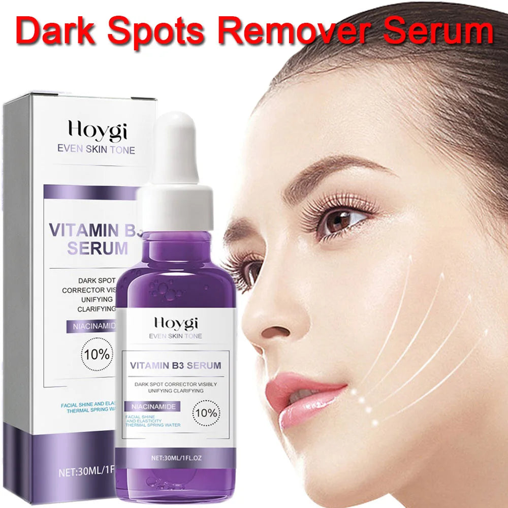 Powerful Dark Spot Remover Whitening Serum – Anti-Freckle Melanin Correcting Brightening Korean Day & Night Facial Care