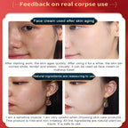 Dragon Blood Anti-Aging Cream – Wrinkle Removal & Firming Facial Serum