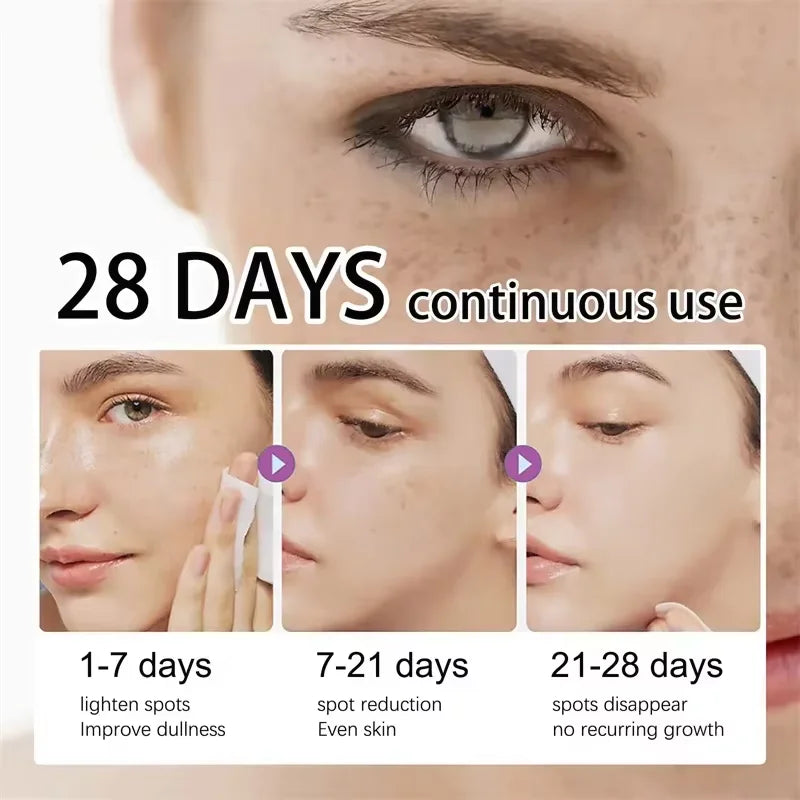 Powerful Dark Spot Remover Whitening Serum – Anti-Freckle Melanin Correcting Brightening Korean Day & Night Facial Care