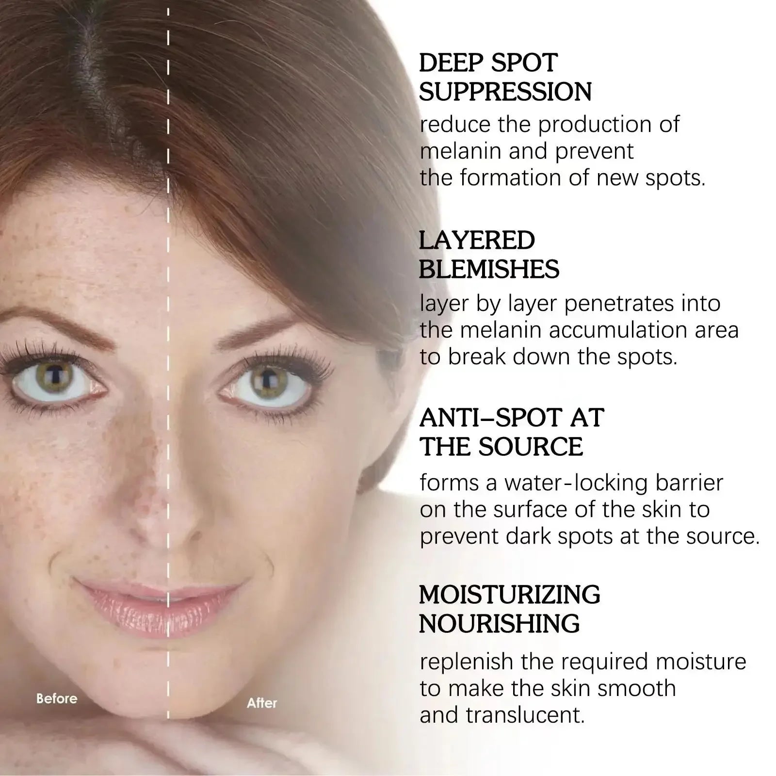 Powerful Dark Spot Remover Whitening Serum – Anti-Freckle Melanin Correcting Brightening Korean Day & Night Facial Care