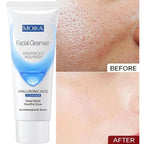 Facial Foam Cleanser – Gentle Pore Cleanser & Oil Control (80g)