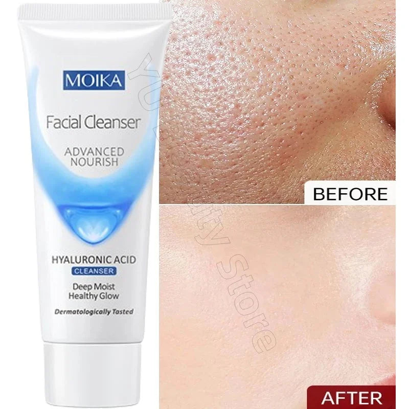 Facial Foam Cleanser – Gentle Pore Cleanser & Oil Control (80g)