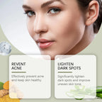Whitening Facial Cleanser – Fades Dark Spots, Reduces Melasma, Brightens & Smooths Skin, Anti-Acne & Moisturizing Care