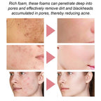 Facial Foaming Cleanser – Deep Clean, Oil Control, Moisturizing, Blackhead Removal
