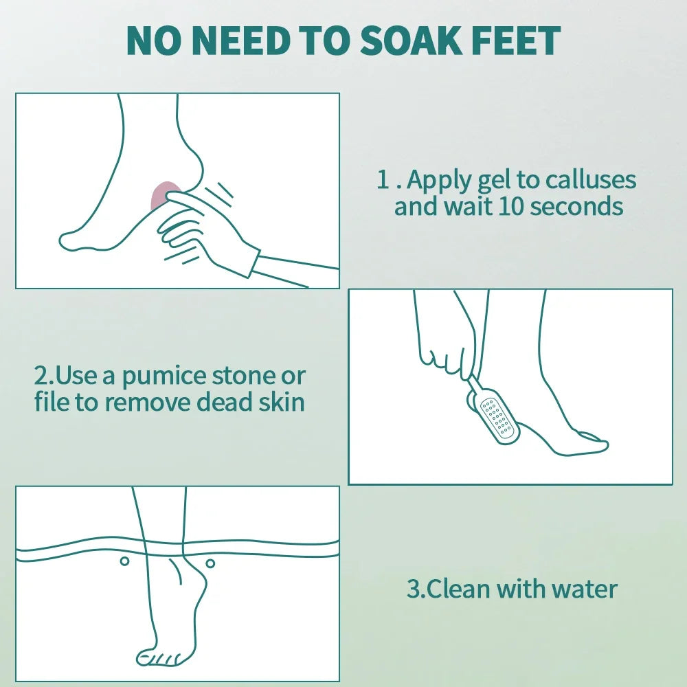 NAILPOP Foot Care Callus Softener Combo – Callus Remover Gel & Foot File Set for Dry, Rough, Cracked Heels