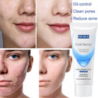Facial Foam Cleanser – Gentle Pore Cleanser & Oil Control (80g)